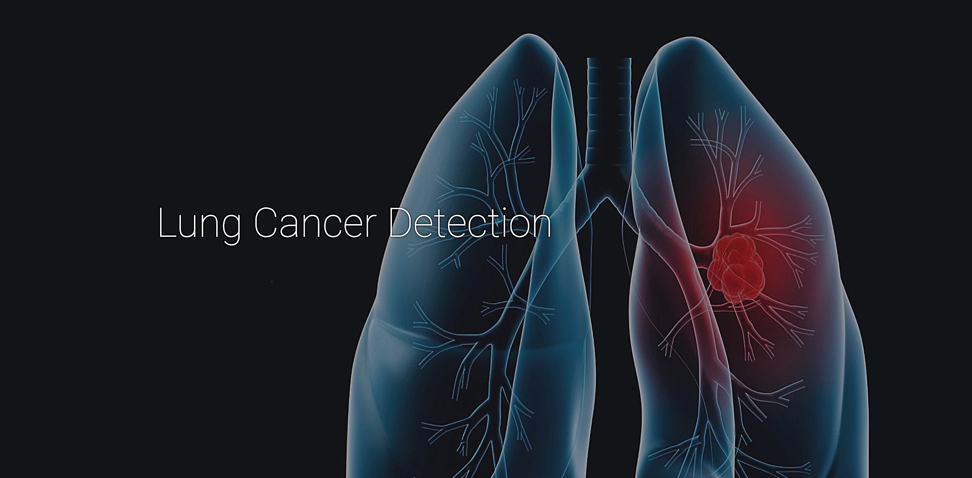 Lung cancer Detection Using Deep Learning